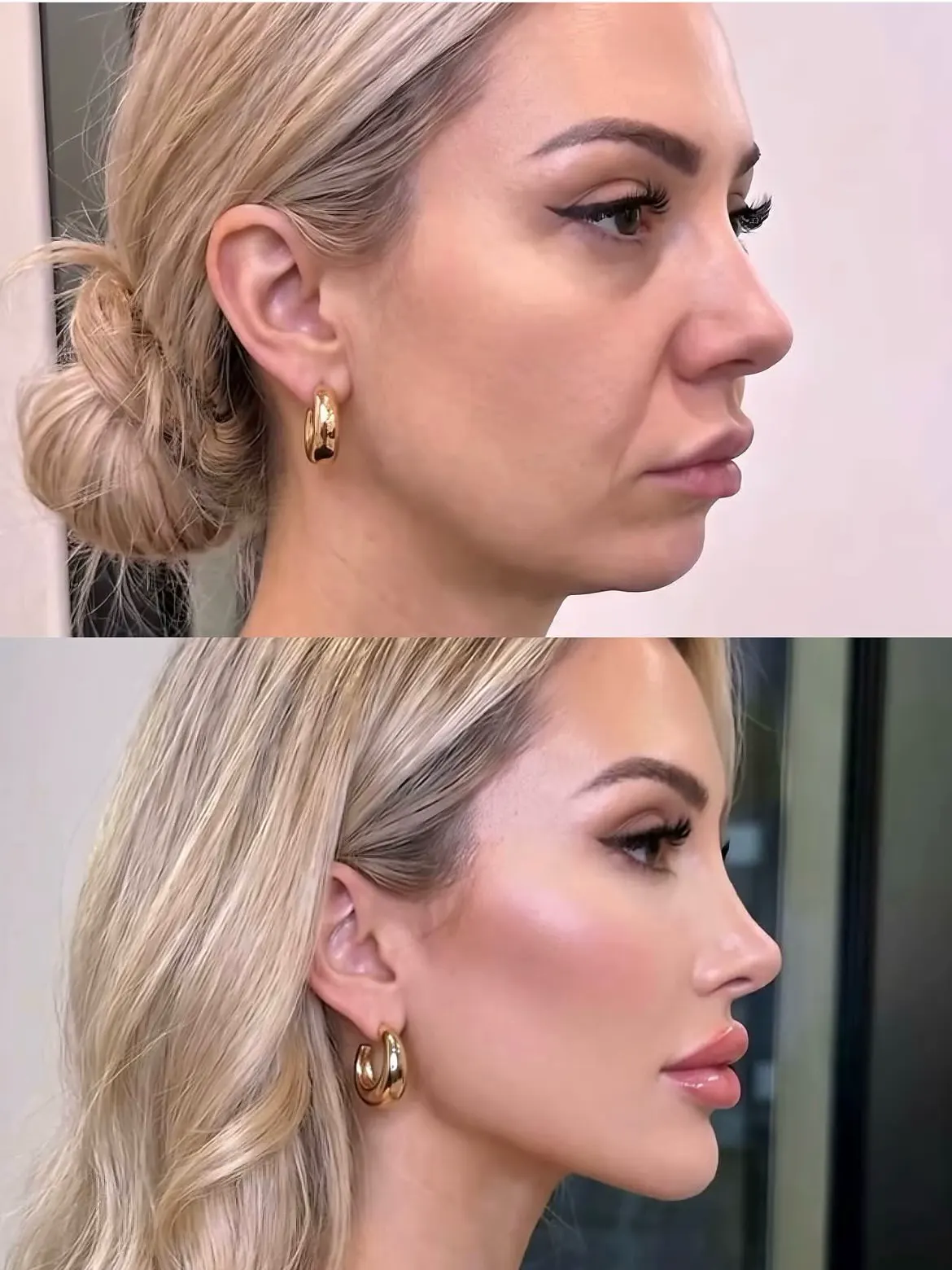 Jawline contour visual reference